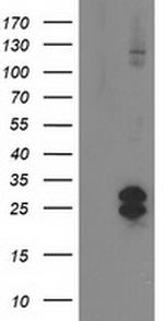FGF21 Antibody in Western Blot (WB)