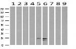 FGF21 Antibody in Western Blot (WB)
