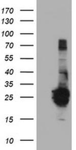 FGF21 Antibody in Western Blot (WB)