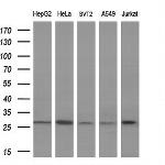 FGF21 Antibody in Western Blot (WB)