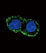 FGF2 Antibody in Immunocytochemistry (ICC/IF)
