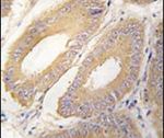 FGF4 Antibody in Immunohistochemistry (IHC)