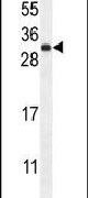 FGF9 Antibody in Western Blot (WB)
