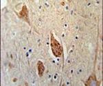 FGFBP3 Antibody in Immunohistochemistry (IHC)