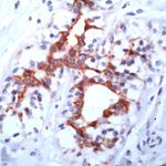 FGFR3 Antibody in Immunohistochemistry (IHC)