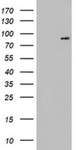 FGFR1 Antibody in Western Blot (WB)