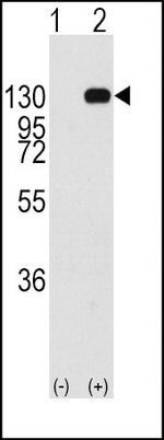 FGFR1 Antibody in Western Blot (WB)