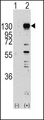 FGFR1 Antibody in Western Blot (WB)