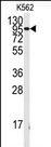 FGFR1 Antibody in Western Blot (WB)