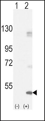 FGFR1 Antibody in Western Blot (WB)