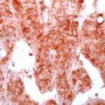FGFR2 Antibody in Immunohistochemistry (IHC)