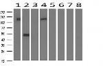 FGFR2 Antibody in Western Blot (WB)