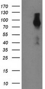 FGFR2 Antibody in Western Blot (WB)