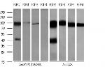FGFR2 Antibody in Western Blot (WB)