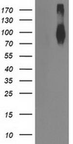 FGFR2 Antibody in Western Blot (WB)