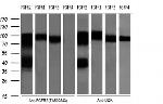 FGFR2 Antibody in Western Blot (WB)