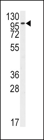 FGFR2 Antibody in Western Blot (WB)