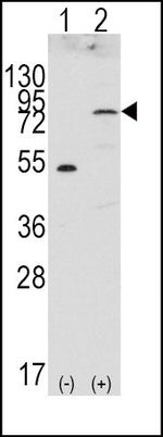 FGFR4 Antibody in Western Blot (WB)