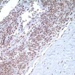 FGG Antibody in Immunohistochemistry (IHC)