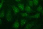 FGG Antibody in Immunocytochemistry (ICC/IF)