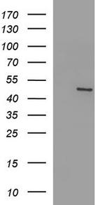 FGG Antibody in Western Blot (WB)