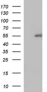 FGG Antibody in Western Blot (WB)