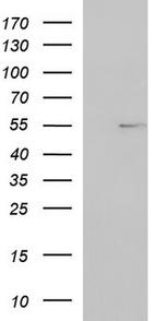FGG Antibody in Western Blot (WB)