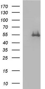 FGG Antibody in Western Blot (WB)
