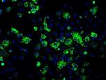 FH Antibody in Immunocytochemistry (ICC/IF)