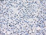FH Antibody in Immunohistochemistry (Paraffin) (IHC (P))