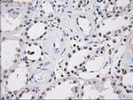 FH Antibody in Immunohistochemistry (Paraffin) (IHC (P))