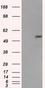 FH Antibody in Western Blot (WB)
