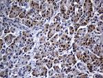FHIT Antibody in Immunohistochemistry (Paraffin) (IHC (P))