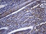 FHIT Antibody in Immunohistochemistry (Paraffin) (IHC (P))