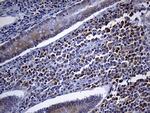 FHIT Antibody in Immunohistochemistry (Paraffin) (IHC (P))