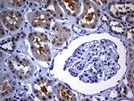 FHIT Antibody in Immunohistochemistry (Paraffin) (IHC (P))