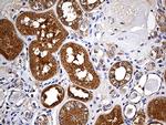 FHIT Antibody in Immunohistochemistry (Paraffin) (IHC (P))