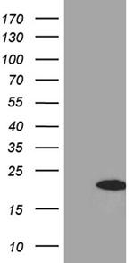 FHIT Antibody in Western Blot (WB)