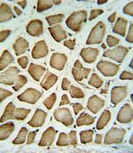 Fibrinogen gamma Antibody in Immunohistochemistry (IHC)