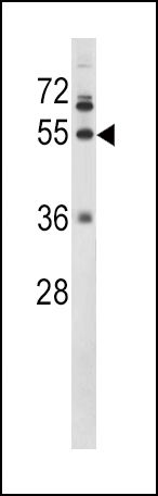 Fibrinogen gamma Antibody in Western Blot (WB)