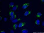 CD107b/LAMP2 Antibody in Immunocytochemistry (ICC/IF)