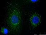 EPHX2 Antibody in Immunocytochemistry (ICC/IF)