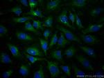 TSG101 Antibody in Immunocytochemistry (ICC/IF)