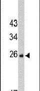 FKBP14 Antibody in Western Blot (WB)