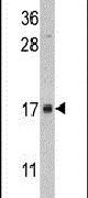 FKBP2 Antibody in Western Blot (WB)