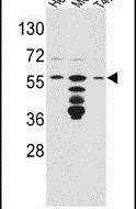 FKBP4 Antibody in Western Blot (WB)