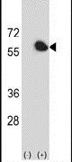 FKBP4 Antibody in Western Blot (WB)