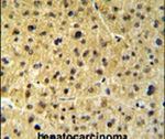 FKBP9 Antibody in Immunohistochemistry (IHC)