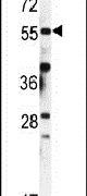 FKBP9 Antibody in Western Blot (WB)