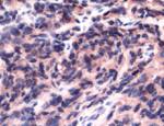 FLI1 Antibody in Immunohistochemistry (IHC)